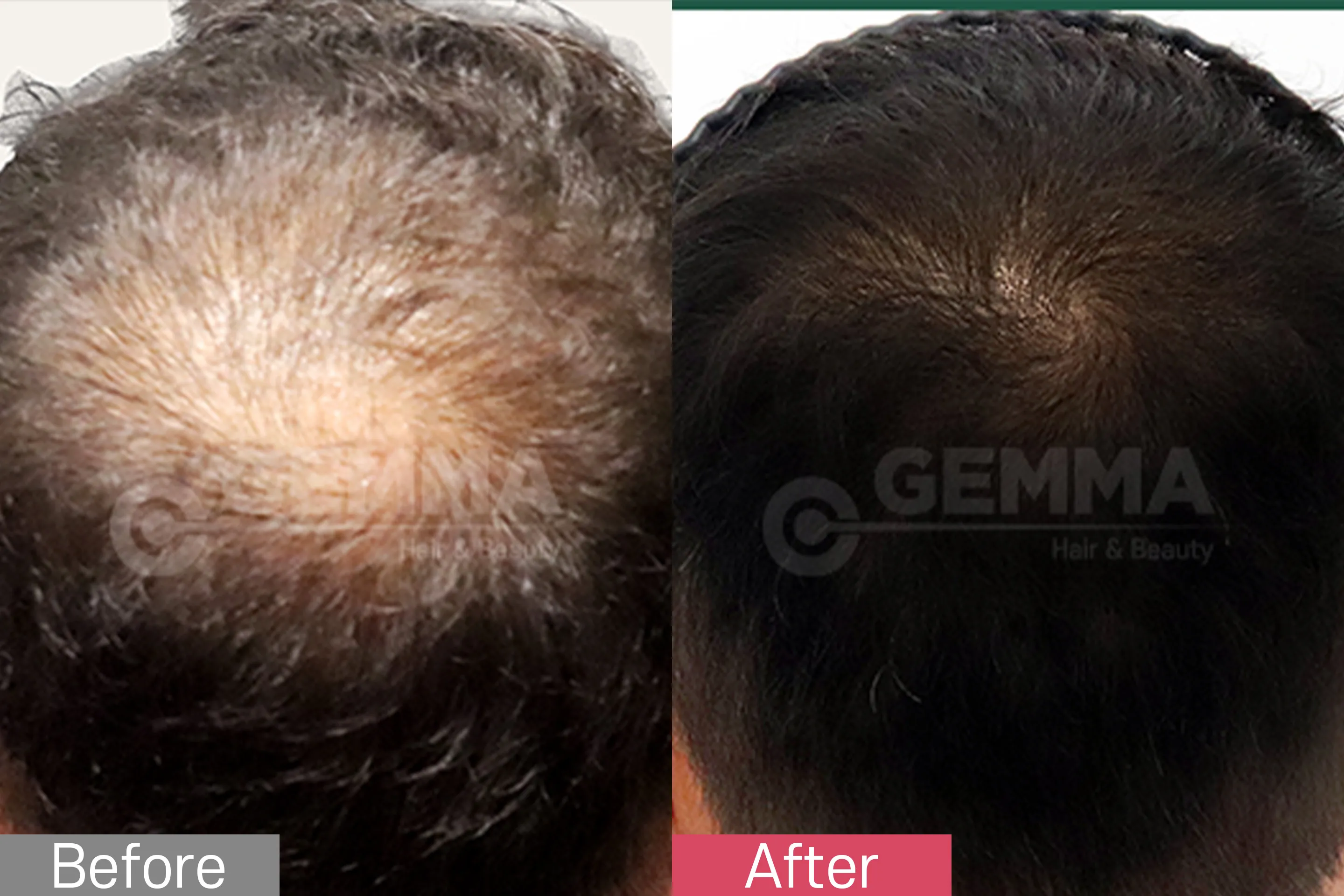 Before & After Image