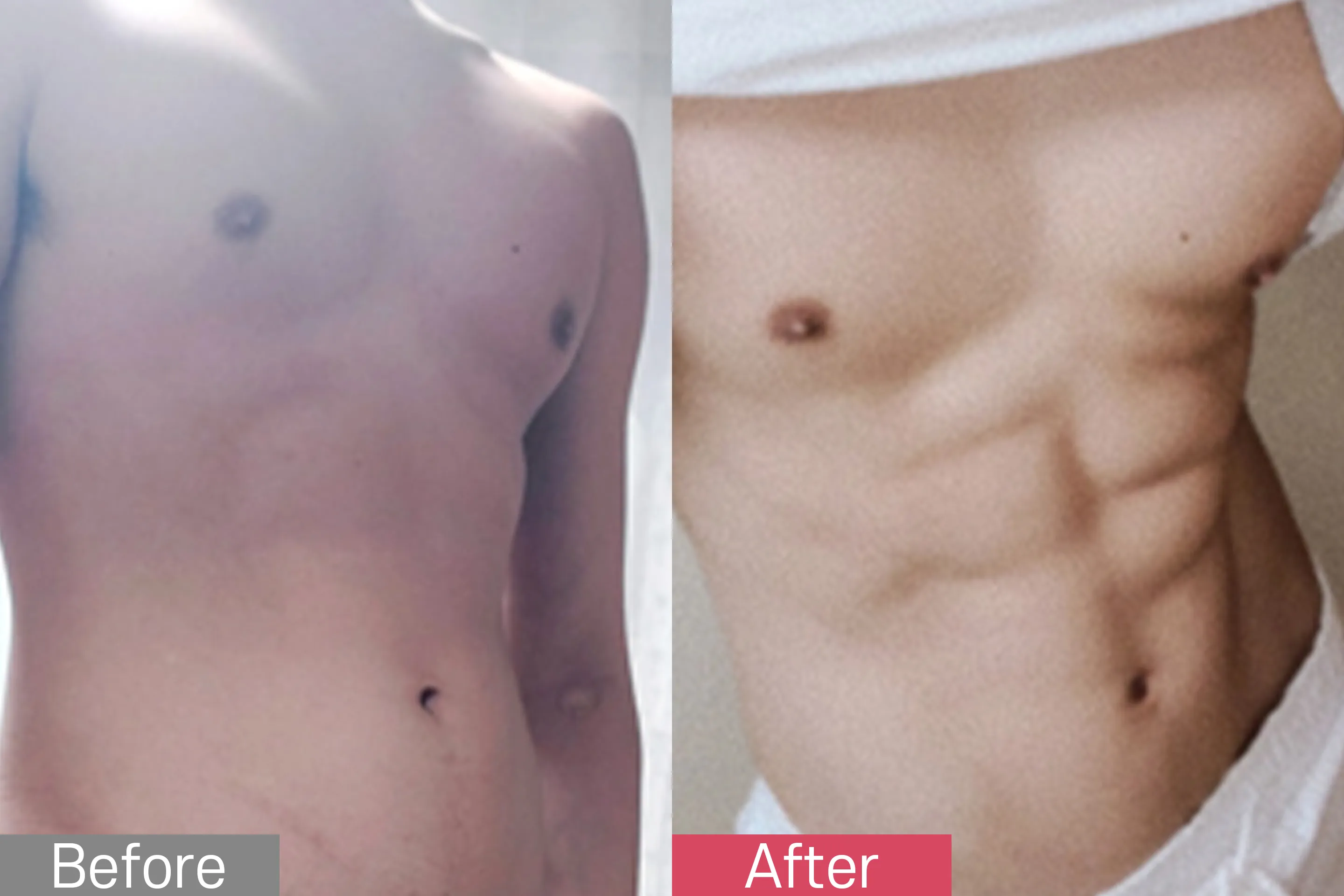 Before & After Image